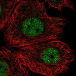 FAM65C Polyclonal Antibody