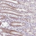 FAM65C Antibody in Immunohistochemistry (Paraffin) (IHC (P))
