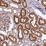 C14orf142 Antibody in Immunohistochemistry (Paraffin) (IHC (P))