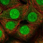 C14orf142 Polyclonal Antibody