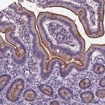 T4S20 Polyclonal Antibody