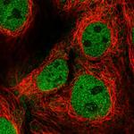 FAM222B Polyclonal Antibody