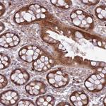 FAM222B Antibody in Immunohistochemistry (Paraffin) (IHC (P))