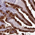 TOR1AIP2 Polyclonal Antibody