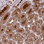 TMEM110 Antibody in Immunohistochemistry (Paraffin) (IHC (P))