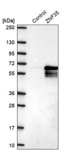 ZNF35 Antibody in Western Blot (WB)