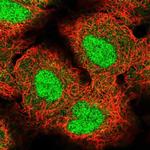 ZNF575 Polyclonal Antibody