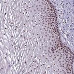 ZNF575 Antibody in Immunohistochemistry (Paraffin) (IHC (P))