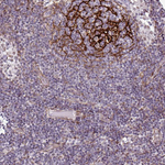 TMEM119 Polyclonal Antibody