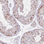 CHTF8 Antibody in Immunohistochemistry (Paraffin) (IHC (P))