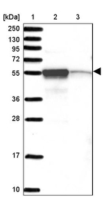 CHTF8 Antibody in Western Blot (WB)