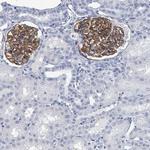 TAS2R1 Polyclonal Antibody