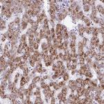 ANKRD13B Polyclonal Antibody