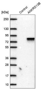 ANKRD13B Antibody in Western Blot (WB)