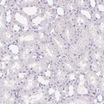 FABP5 Antibody in Immunohistochemistry (Paraffin) (IHC (P))