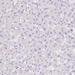 FABP5 Antibody in Immunohistochemistry (Paraffin) (IHC (P))