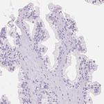 FABP5 Polyclonal Antibody