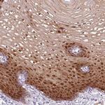 FABP5 Antibody in Immunohistochemistry (IHC)