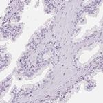 FABP5 Antibody in Immunohistochemistry (IHC)