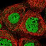 ALG8 Antibody in Immunocytochemistry (ICC/IF)