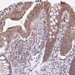 ALG8 Antibody in Immunohistochemistry (Paraffin) (IHC (P))