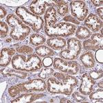 ALG8 Antibody in Immunohistochemistry (Paraffin) (IHC (P))