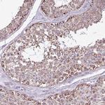 ALG8 Antibody in Immunohistochemistry (Paraffin) (IHC (P))
