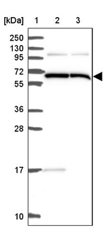 ALG8 Antibody in Western Blot (WB)