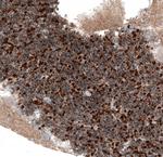 SERPINE3 Antibody in Immunohistochemistry (IHC)