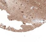 SERPINE3 Polyclonal Antibody