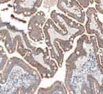 SERPINE3 Antibody in Immunohistochemistry (IHC)