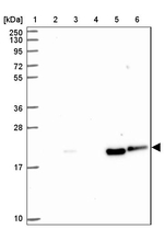 CRHSP-24 Antibody in Western Blot (WB)