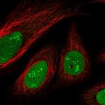 SAMD14 Antibody in Immunocytochemistry (ICC/IF)