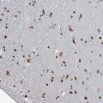 SAMD14 Antibody in Immunohistochemistry (Paraffin) (IHC (P))