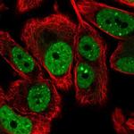 LRRC41 Polyclonal Antibody