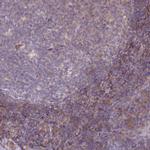 LRRC41 Antibody in Immunohistochemistry (IHC)