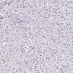 SLC7A8 Antibody in Immunohistochemistry (IHC)