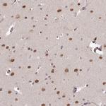 SKIV2L Antibody in Immunohistochemistry (IHC)