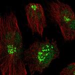 RHBDD2 Antibody in Immunocytochemistry (ICC/IF)