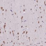 RHBDD2 Antibody in Immunohistochemistry (Paraffin) (IHC (P))