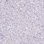 RHBDD2 Antibody in Immunohistochemistry (Paraffin) (IHC (P))