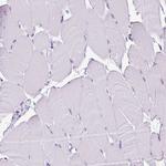 RHBDD2 Antibody in Immunohistochemistry (Paraffin) (IHC (P))