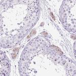 RHBDD2 Antibody in Immunohistochemistry (Paraffin) (IHC (P))