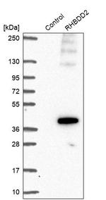 RHBDD2 Antibody in Western Blot (WB)