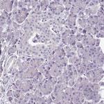 TMEM132A Polyclonal Antibody