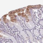 TMEM132A Antibody in Immunohistochemistry (Paraffin) (IHC (P))