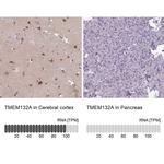 TMEM132A Antibody in Immunohistochemistry (IHC)