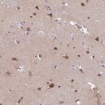 TMEM132A Antibody in Immunohistochemistry (IHC)