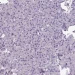 TMEM132A Antibody in Immunohistochemistry (IHC)