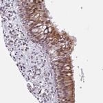 ZCCHC5 Antibody in Immunohistochemistry (Paraffin) (IHC (P))